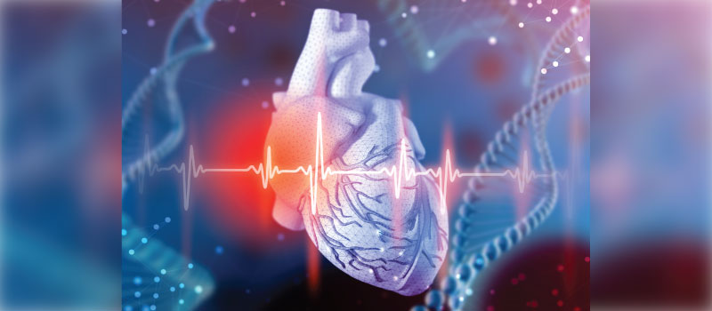 Broken Heart Syndrome cardiomyopathy